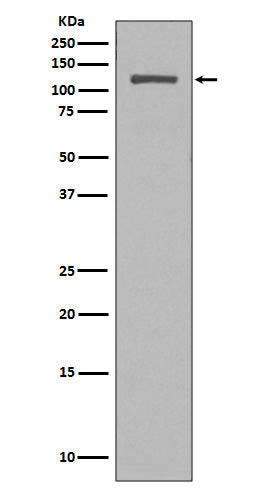 Western blot analysis of NUP98 expression in HeLa cell lysate.