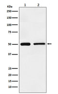 Western blot analysis of TIM 1 expression in (1) HeLa cell lysate; (2) NIH/3T3 cell lysate.