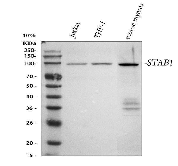 Anti-SATB1 Rabbit Monoclonal Antibody