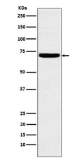 Western blot analysis of Heparanase 1 expression in K562 cell lysate.