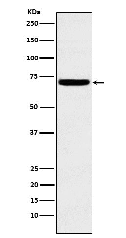 Western blot analysis of Heparanase 1 expression in K562 cell lysate.