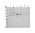 Anti-RPA70 Monoclonal Antibody