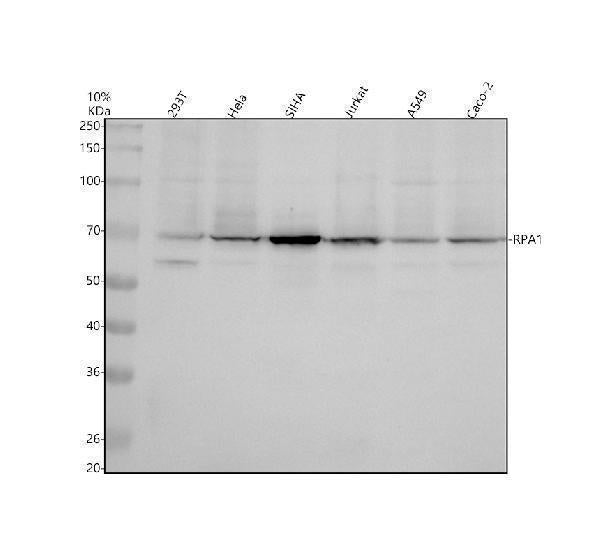 Anti-RPA70 Monoclonal Antibody