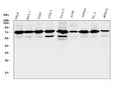 Anti-RPA70 RPA1 Antibody Picoband® (monoclonal, 11H4)