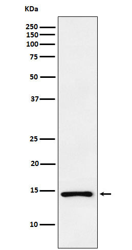 Western blot analysis of ANP expression in PC3 cell lysate.
