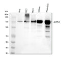 Anti-CPS1 Monoclonal Antibody