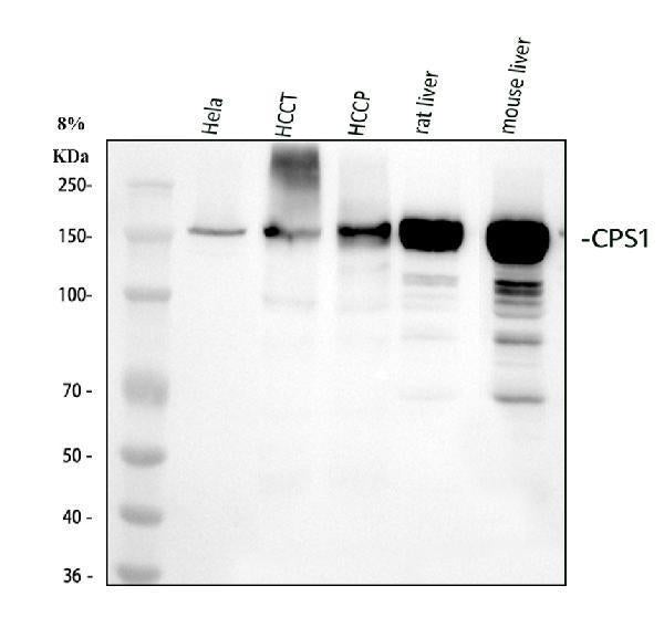 Anti-CPS1 Monoclonal Antibody
