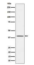 Anti-TTF1 Rabbit Monoclonal Antibody