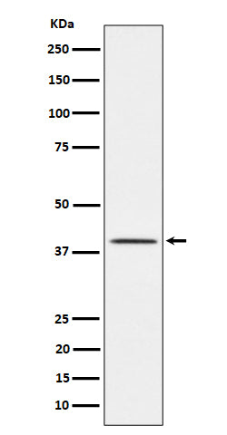Anti-TTF1 Rabbit Monoclonal Antibody