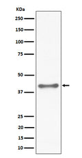 Western blot analysis of TTF1 expression in HeLa cell lysate.