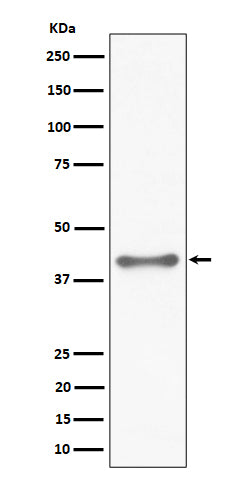 Western blot analysis of TTF1 expression in HeLa cell lysate.