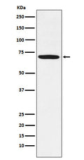 Western blot analysis of LIM Kinase 1  expression in U-87MG cell lysate.