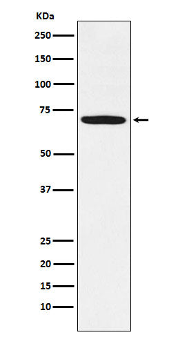 Western blot analysis of LIM Kinase 1  expression in U-87MG cell lysate.
