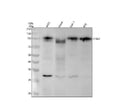Anti-Thrombomodulin THBD Rabbit Monoclonal Antibody