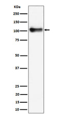 Western blot analysis of Thrombomodulin / CD141 expression in mouse lung cell lysate.