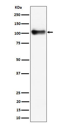 Western blot analysis of Thrombomodulin / CD141 expression in mouse lung cell lysate.
