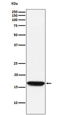 Western blot analysis of NM23A expression in Jurkat cell lysate.