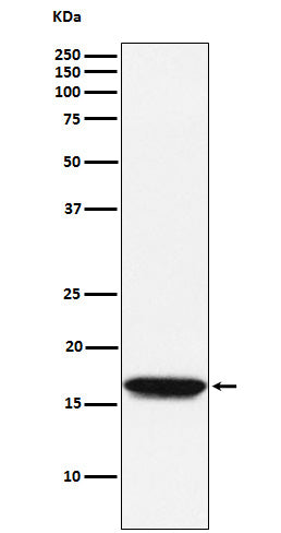 Western blot analysis of NM23A expression in Jurkat cell lysate.
