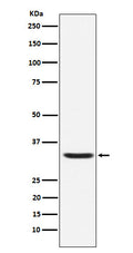 Western blot analysis of Hepcidin expression in Human Hepcidin Full-length Recombinant Protein (GFP Tagged).
