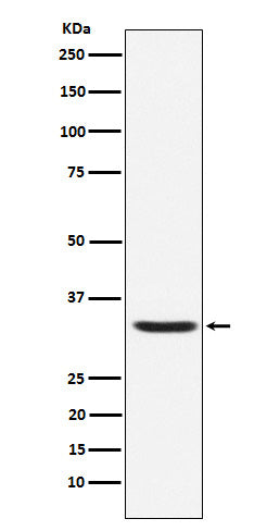 Western blot analysis of Hepcidin expression in Human Hepcidin Full-length Recombinant Protein (GFP Tagged).
