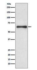 Western blot analysis of Cdc6 expression in Hela cell lysate treated with hydroxyurea.