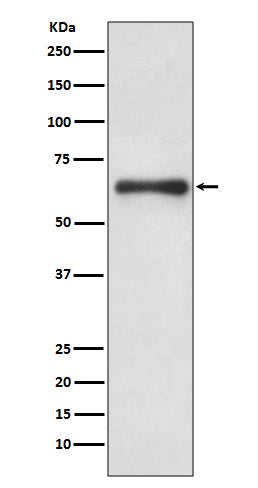 Western blot analysis of Cdc6 expression in Hela cell lysate treated with hydroxyurea.