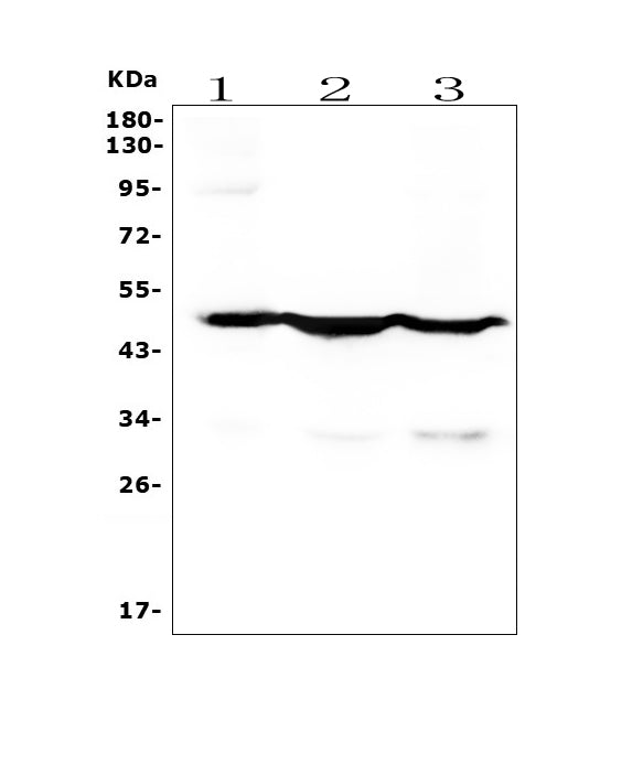 Anti-Cytokeratin 18 KRT18 Antibody Picoband®(monoclonal, 7I6)