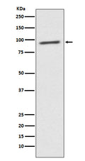 Western blot analysis of STAT2 expression in K562 cell lysate.