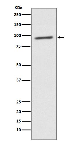 Western blot analysis of STAT2 expression in K562 cell lysate.