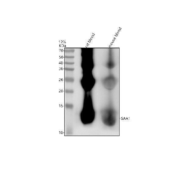 Anti-Serum Amyloid A SAA1 Rabbit Monoclonal Antibody