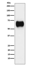 Western blot analysis of MICA expression in A431 cell lysate.