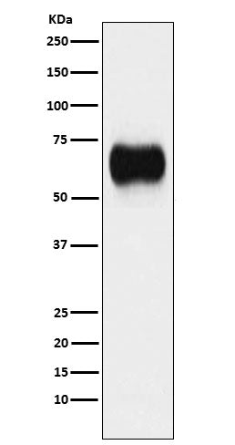 Western blot analysis of MICA expression in A431 cell lysate.