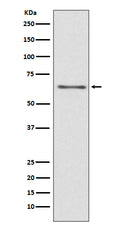 Western blot analysis of CDC45 expression in Jurkat cell lysate.