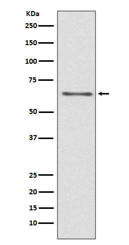 Western blot analysis of CDC45 expression in Jurkat cell lysate.