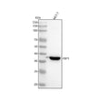 Anti-FBP1 Rabbit Monoclonal Antibody