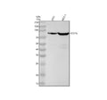 Anti-Periostin Monoclonal Antibody