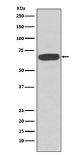 Western blot analysis of PKR expression in MCF-7 cell lysate.