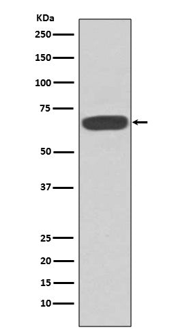 Western blot analysis of PKR expression in MCF-7 cell lysate.