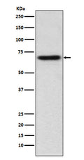 Western blot analysis of ITK expression in Jurkat cell lysate.