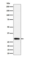 Western blot analysis of NAT1 expression in LnCaP cell lysate.
