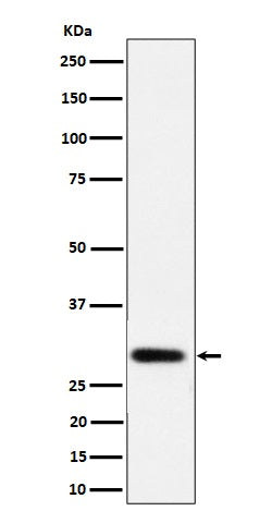Western blot analysis of NAT1 expression in LnCaP cell lysate.