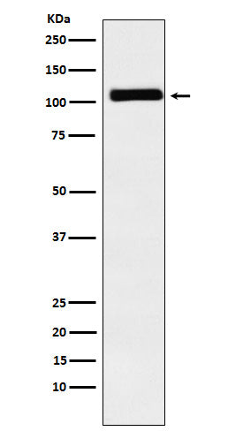 Western blot analysis of MIB1 / DIP1 expression in Caco2 cell lysate.