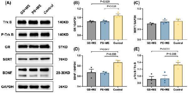 Anti-TrkB Rabbit Monoclonal Antibody