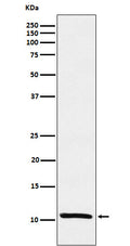 Western blot analysis of Estrogen Inducible Protein pS2 expression in MCF-7 cell lysate.