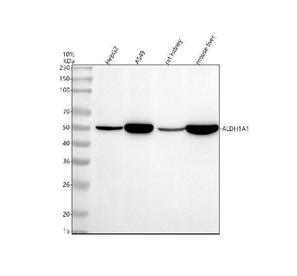 Anti-ALDH1A1 Rabbit Monoclonal Antibody