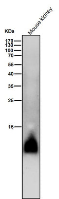 All lanes use the Antibody at 1:2W dilution for 1 hour at room temperature.