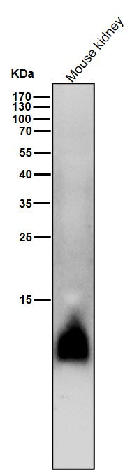 All lanes use the Antibody at 1:2W dilution for 1 hour at room temperature.