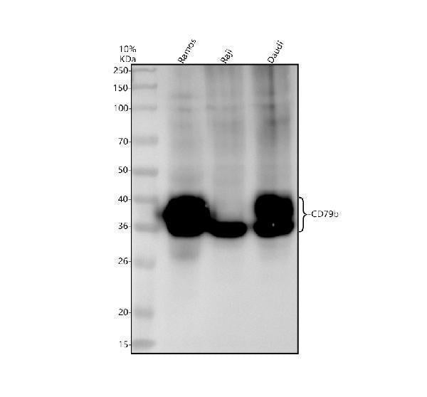 Anti-CD79b Rabbit Monoclonal Antibody