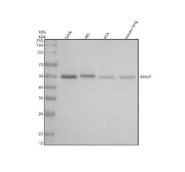 Anti-TXNIP Monoclonal Antibody