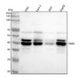 Anti-TRIB3 Monoclonal Antibody